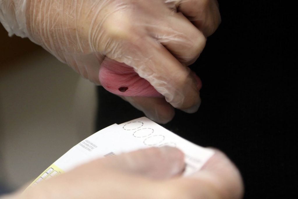 56b6c120 Teste Pezinho Scaled 1024x683