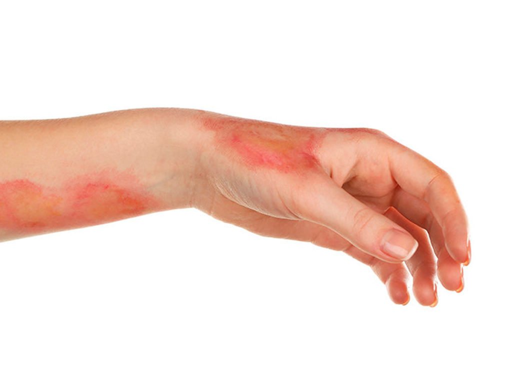 78adbaaf Ilustra 1024x742