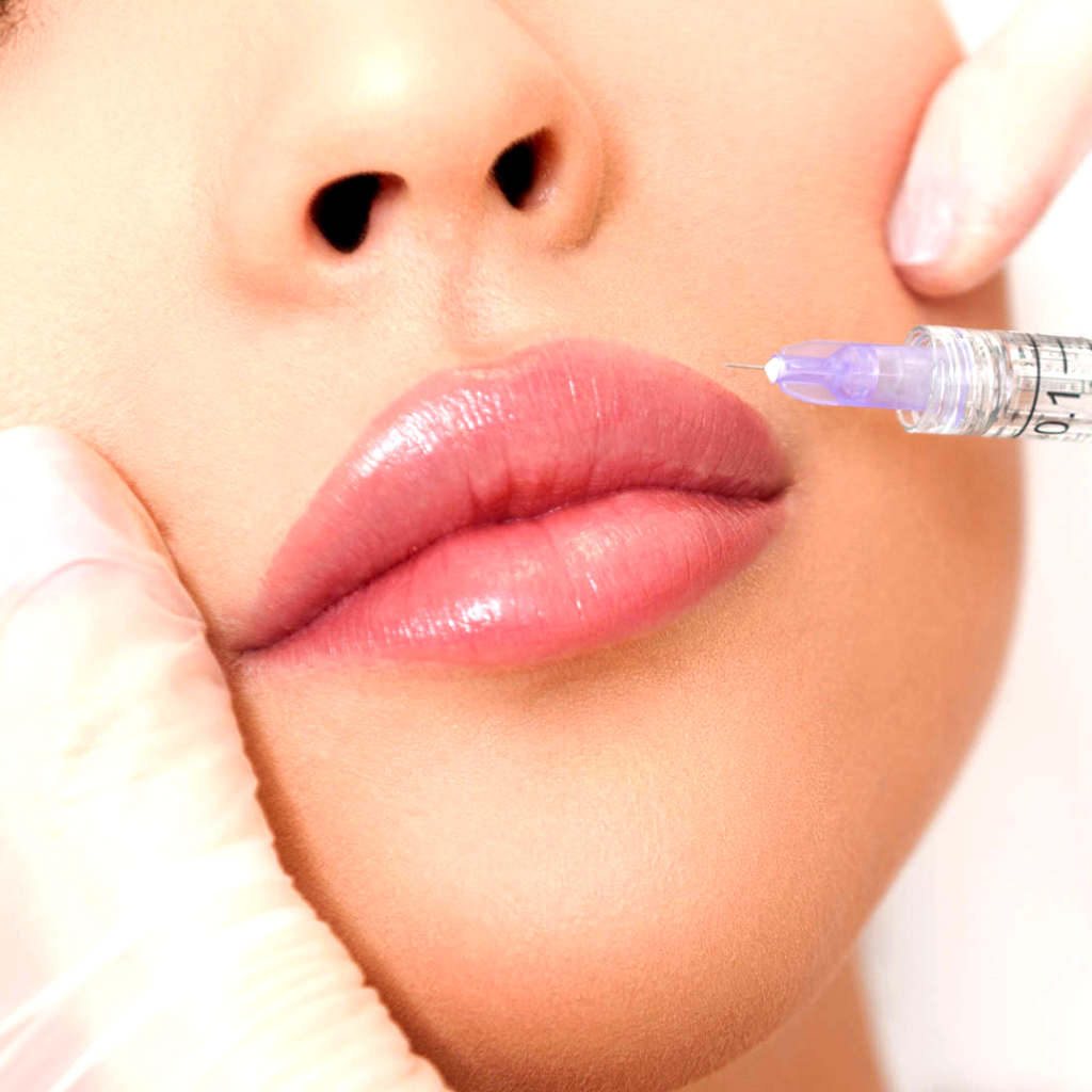 Curiosidades sobre preenchimento labial: tudo o que você precisa saber 91d8709f Ilustra 1024x1024