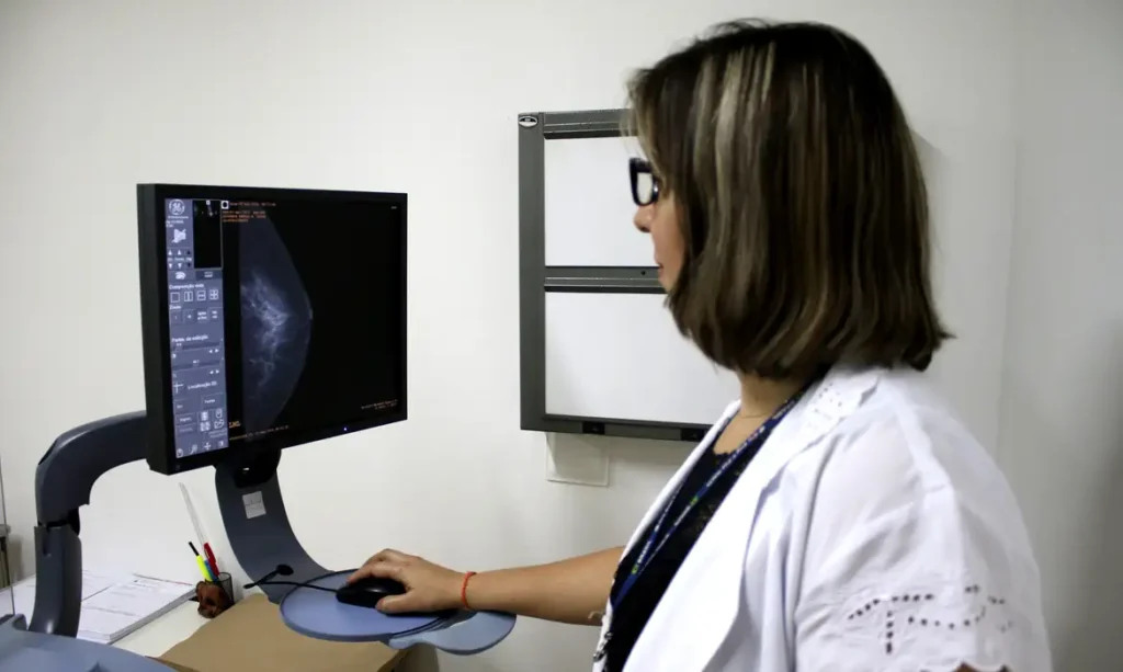 Ministério da Saúde amplia mamografia no SUS para mulheres a partir dos 40 anos mamografia
