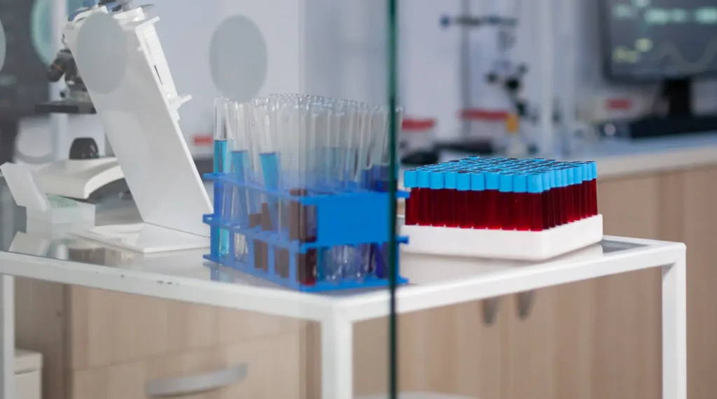 Exame de sangue pode facilitar diagnóstico do Alzheimer no Brasil laboratório