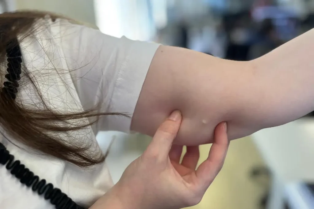 implante contraceptivo sesa