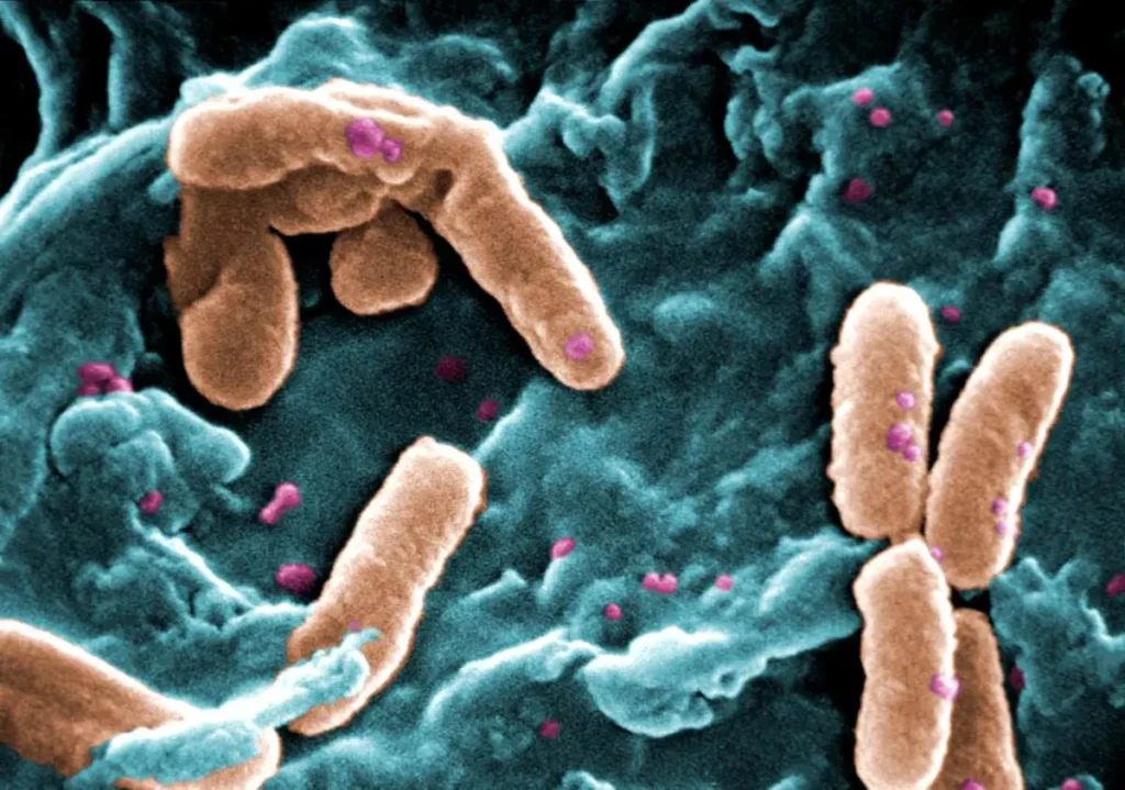 Pseudomonas aeruginosa