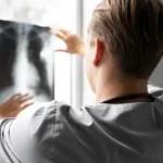 radiografia de pumão